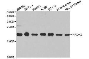 Western blot analysis of extracts of various cell lines, using PRDX2 antibody. (Peroxiredoxin 2 Antikörper  (AA 1-142))