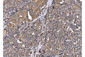 IHC analysis of MLX-interacting protein/MLXIP using anti-MLX-interacting protein/MLXIP antibody (ABIN7602593). (MLXIP Antikörper  (AA 88-348))