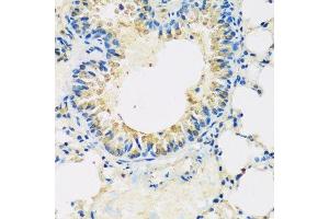 Immunohistochemistry of paraffin-embedded mouse lung using ABCF2 antibody. (ABCF2 Antikörper  (AA 1-250))