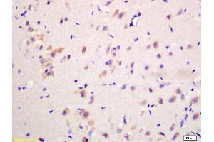 Immunohistochemistry (IHC) image for anti-Guanine Nucleotide Binding Protein (G Protein), beta Polypeptide 3 (GNB3) (AA 101-200) antibody (ABIN739094)