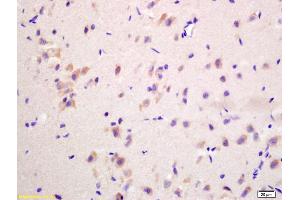 Formalin-fixed and paraffin embedded rat brain labeled with Anti-G protein beta subunit GI Polyclonal Antibody, Unconjugated (ABIN739094) at 1:200 followed by conjugation to the secondary antibody and DAB staining (GNB3 Antikörper  (AA 101-200))