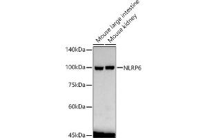 Western blot analysis of extracts of various cell lines, using NLRP6 antibody  at 1:1570 dilution. (NLRP6 Antikörper  (AA 100-200))
