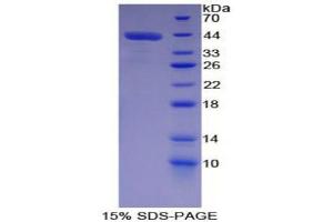 SDS-PAGE (SDS) image for Chemokine (C-C Motif) Ligand 22 (CCL22) (AA 1-93) protein (His tag,GST tag) (ABIN2123211)