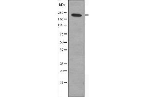 Western blot analysis of extracts from HepG2 cells, treated with serum (20%, 15mins), using ZNF638 antibody.
