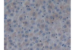 Fibromodulin Antikörper  (AA 19-376)