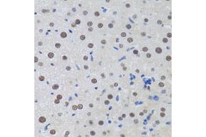 Immunohistochemistry of paraffin-embedded rat liver using MT antibody (ABIN6128251, ABIN6144117, ABIN6144118 and ABIN6222360) at dilution of 1:100 (40x lens). (MTA3 Antikörper  (AA 40-330))
