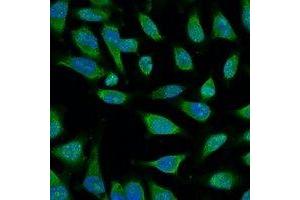 Immunofluorescent analysis of HSP70 staining in Hela cells. (HSP70 Antikörper)