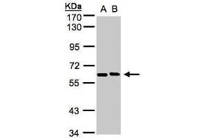 WB Image Sample(30 ug whole cell lysate) A:H1299 B:HeLa S3, 7. (NT5C2 Antikörper)