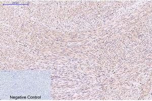 Immunohistochemical analysis of paraffin-embedded human uterus tissue. (EFHD1 Antikörper)