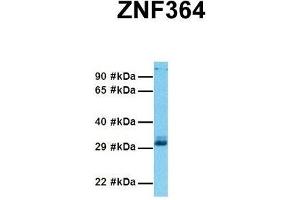 Host:  Rabbit  Target Name:  ZNF364  Sample Tissue:  Human 293T  Antibody Dilution:  1. (RNF115 Antikörper  (C-Term))