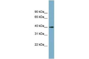 WB Suggested Anti-SLC25A22 Antibody Titration:  0. (SLC25A22 Antikörper  (N-Term))