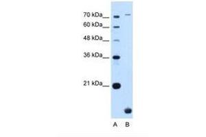 Image no. 1 for anti-Transmembrane Protein 91 (TMEM91) (N-Term) antibody (ABIN6739191)