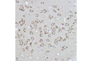 Immunohistochemistry (IHC) image for anti-Ionized Calcium-binding Adapter Molecule 1 (IBA1) (AA 1-147) antibody (ABIN6136676)