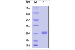 SDS-PAGE (SDS) image for Leukocyte-Associated Immunoglobulin-Like Receptor 2 (LAIR2) (AA 22-152) protein (His tag,AVI tag,Biotin) (ABIN5674601)