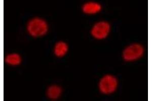 ABIN6275443 staining Hela by IF/ICC. (RANBP17 Antikörper  (N-Term))