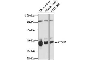 Western blot analysis of extracts of various cell lines, using PTGFR antibody (ABIN6293503) at 1:1000 dilution. (PTGFR Antikörper)