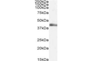 Western Blot using anti-Lymphotoxin alpha antibody 3F12. (Rekombinanter LTA Antikörper)