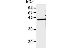 Western Blotting (WB) image for anti-Recombinase A / RecA (AA 260-347) antibody (ABIN1449298) (Recombinase A / RecA (AA 260-347) Antikörper)
