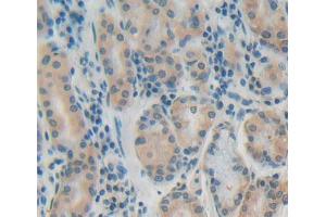 Used in DAB staining on fromalin fixed paraffin- embedded stomach tissue (PTP4A1 Antikörper  (AA 1-173))