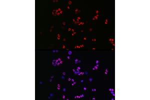Immunofluorescence analysis of F9 cells using [KO Validated] SOX2 Rabbit pAb (ABIN3021002, ABIN3021003, ABIN3021004 and ABIN6213889) at dilution of 1:50 (40x lens). (SOX2 Antikörper  (AA 1-140))