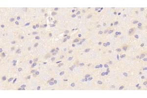 Immunohistochemistry (IHC) image for anti-Nuclear Factor (erythroid-Derived 2)-Like 2 (NFE2L2) (AA 382-604) antibody (ABIN7441676)