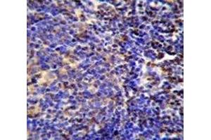Immunohistochemistry (IHC) image for anti-S100 Calcium Binding Protein A4 (S100A4) (AA 1-30) antibody (ABIN3032512)