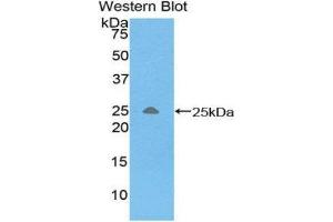 Western Blotting (WB) image for anti-Triggering Receptor Expressed On Myeloid Cells 1 (TREM1) (AA 21-205) antibody (ABIN1860864)