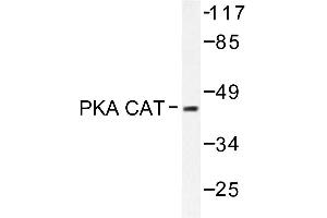Image no. 1 for anti-V-Akt Murine Thymoma Viral Oncogene Homolog 1 (AKT1) antibody (ABIN272061) (AKT1 Antikörper)