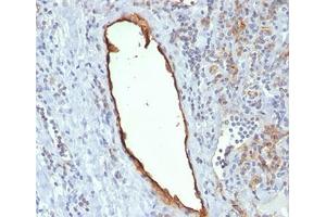 Immunohistochemistry (IHC) image for anti-Platelet/endothelial Cell Adhesion Molecule (PECAM1) antibody (ABIN3025390)