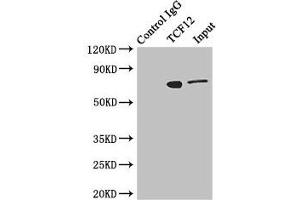 Immunoprecipitating TCF12 in Jurkat whole cell lysate Lane 1: Rabbit control IgG instead of (1 μg) instead of ABIN7172449 in Jurkat whole cell lysate. (TCF12 Antikörper  (AA 443-682))