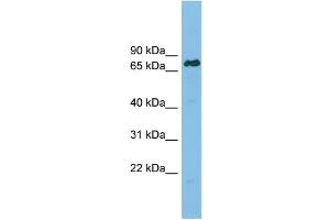 WB Suggested Anti-LBR Antibody Titration: 0. (Lamin B Receptor Antikörper  (Middle Region))