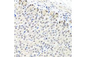 Immunohistochemistry of paraffin-embedded mouse stomach using CNOT8 antibody. (CNOT8 Antikörper)