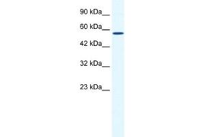 WB Suggested Anti-BTBD15 Antibody Titration:  0. (ZBTB44 Antikörper  (C-Term))