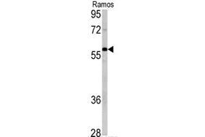 Western blot analysis of XIAP polyclonal antibody  in Ramos cell lysate (35 ug/lane).