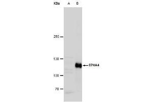 WB Image Eph receptor A4 antibody [N3C2], Internal detects Eph receptor A4 protein by western blot analysis. (EPH Receptor A4 Antikörper)