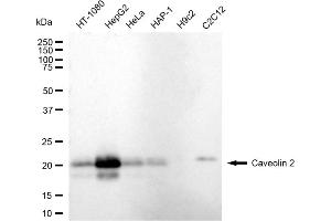 Western blotting analysis using Caveolin 2 antibody (ABIN7797946).