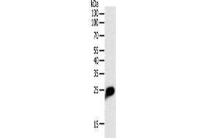 Western Blotting (WB) image for anti-C-Reactive Protein (CRP) antibody (ABIN2421438) (CRP Antikörper)