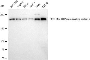 Western blotting analysis using Rho GTPase activating protein 5 antibody (ABIN7800199). (Rekombinanter ARHGAP5 Antikörper)