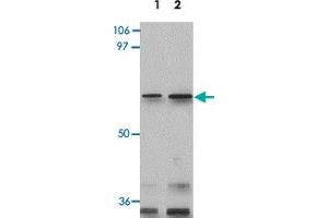 Western blot analysis of GLS2 in rat kidney tissue lysate with GLS2 polyclonal antibody  at 0.
