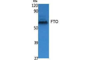 Western Blotting (WB) image for anti-Fat Mass and Obesity-Associated (FTO) (N-Term) antibody (ABIN3178067) (FTO Antikörper  (N-Term))