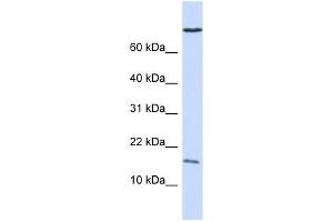 GABARAP antibody used at 1 ug/ml to detect target protein. (GABARAP Antikörper)