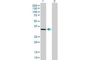 Western Blot analysis of HSA9761 expression in transfected 293T cell line by HSA9761 MaxPab polyclonal antibody. (DIMT1 Antikörper  (AA 1-313))