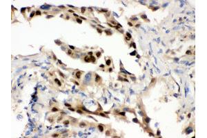 Immunohistochemistry (Paraffin-embedded Sections) (IHC (p)) image for anti-Heat Shock 70kDa Protein 1A (HSPA1A) (AA 559-596), (C-Term) antibody (ABIN3043849) (HSP70 1A Antikörper  (C-Term))