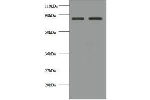 Western blot All lanes: CDH12 antibody at 2 μg/mL Lane 1: EC109 whole cell lysate Lane 2: 293T whole cell lysate Secondary Goat polyclonal to rabbit IgG at 1/10000 dilution Predicted band size: 89, 85 kDa Observed band size: 85 kDa (Cadherin 12 Antikörper  (AA 56-605))
