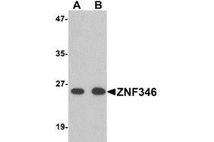 Western blot analysis of TRIP6 in EL4 cell lysate with TRIP6 antibody at 1 μg/ml. (ZNF346 Antikörper  (N-Term))
