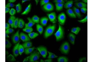 Immunofluorescence (IF) image for anti-Fc Fragment of IgG, Low Affinity IIIb, Receptor (CD16b) (FCGR3B) (AA 18-125) antibody (ABIN7158551)