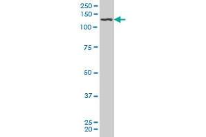 PDGFRB monoclonal antibody (M08), clone 4C12. (PDGFRB Antikörper  (AA 33-133))