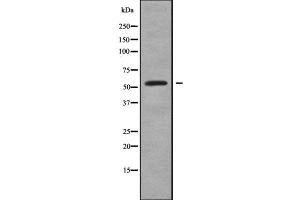 Western blot analysis GABRR2 using LOVO whole cell lysates (GABRR2 Antikörper  (Internal Region))