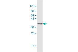 Western Blot detection against Immunogen (38. (TLR5 Antikörper  (AA 517-634))