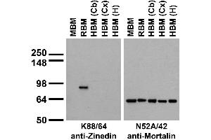 anti-Striatin, Calmodulin Binding Protein 4 (STRN4) (AA 42-354) antibody